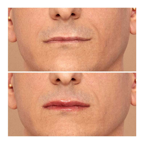 Nabla - protetor labial volumizante Lip Plumper Viper