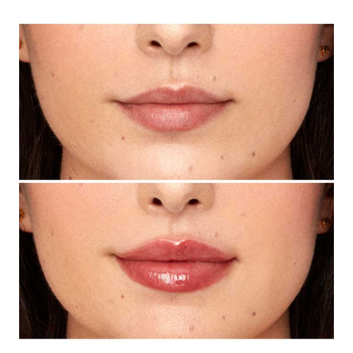 Nabla - protetor labial volumizante Lip Plumper Viper