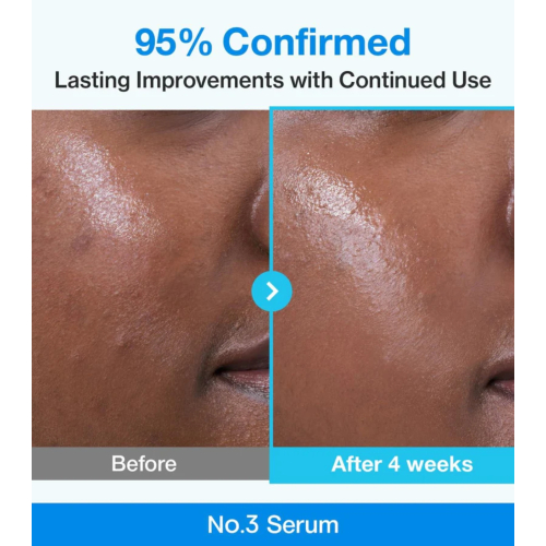 Numbuzin - Sérum Minimiza Poros No.3 Blue Bio-Retinol