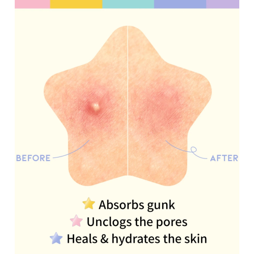 OOTD Beauty - Patch de manchas estelares Star Spot Patch