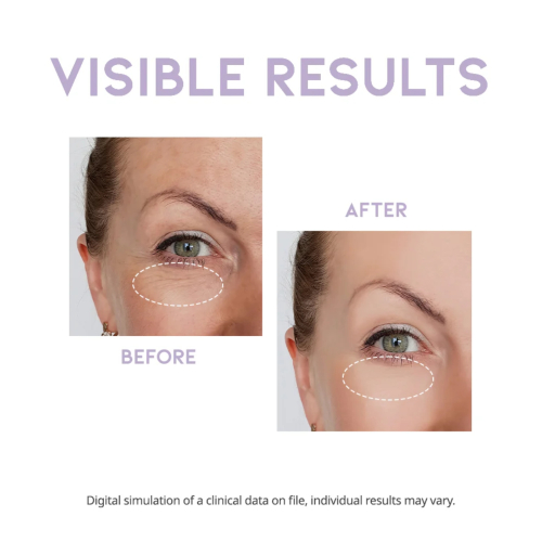 OOTD Beauty - Sérum noturno para os olhos