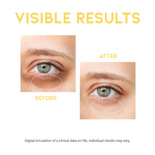 OOTD Beauty - Sérum Iluminador para os Olhos Dark Circle