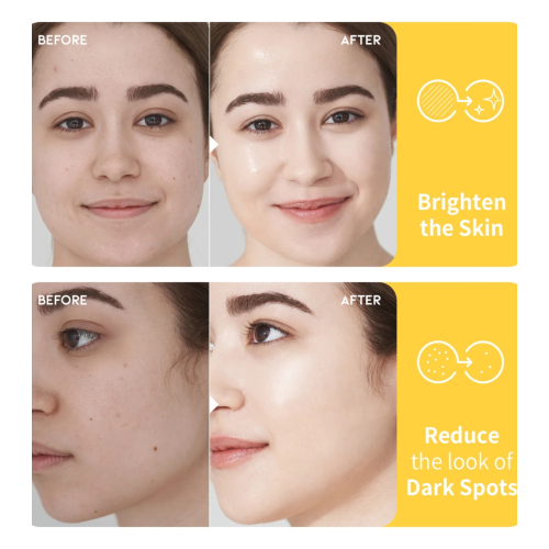 OOTD Beauty - Dark Spot Vitamin C Tônico iluminador