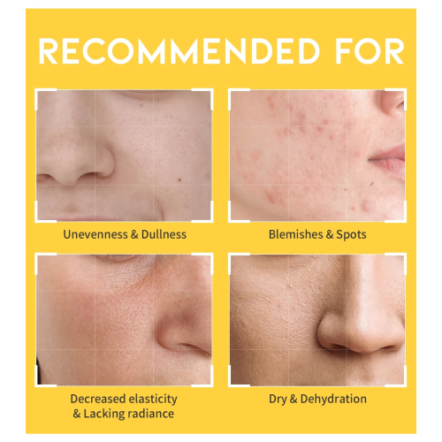 OOTD Beauty - Dark Spot Vitamin C Tônico iluminador