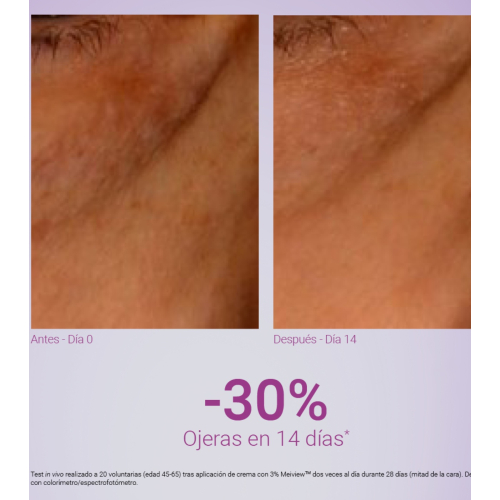 Primaderm - Contorno de olhos antirrugas Xpert Expression Contour