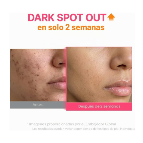 Purito - Sérum iluminador TXA 6 Niacinamide 10 Retinal