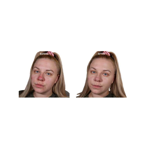 Revolution - Primer de cor creme Superbase Colour Correcting - Green