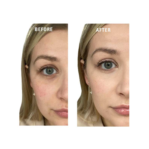 Revolution - Primer de cor creme Superbase Colour Correcting - Yellow