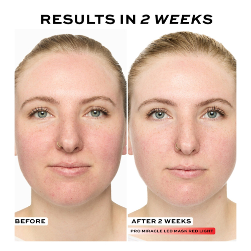 Revolution Pro - Máscara facial Miracle LED Face Mask