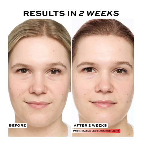 Revolution Pro - Máscara facial Miracle LED Face Mask