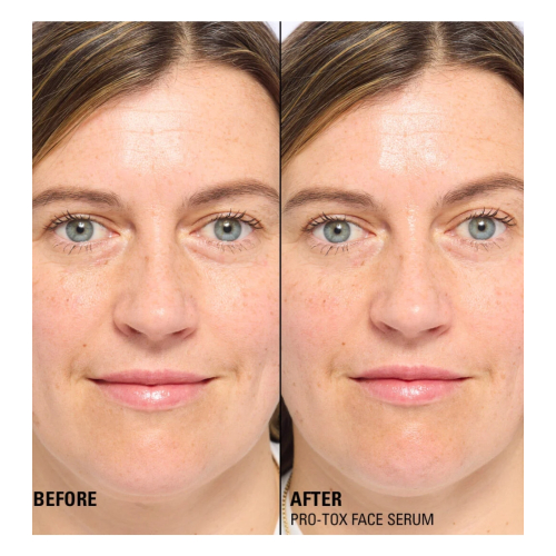 Revolution Pro - *Miracle Pro-Tox* - Sérum facial reparador e preenchedor de linhas