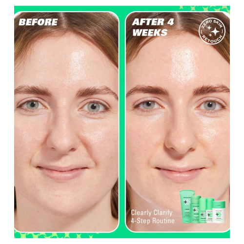 Revolution Skin - *Clearly Clarify* - Sérum facial clareador com 5% de niacinamida e 2% de ácido salicílico Clear Canvas