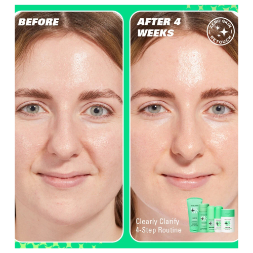 Revolution Skin - *Clearly Clarify* - Sérum facial clareador 10% niacinamida Serum Supreme