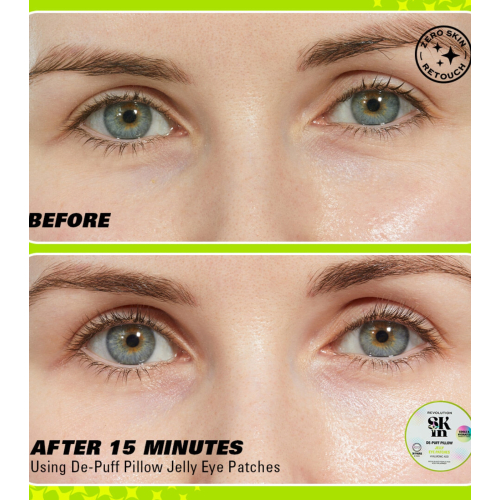 Revolution Skin - Adesivos de hidrogel para os olhos com ácido hialurônico Jelly De-Puff Pillow