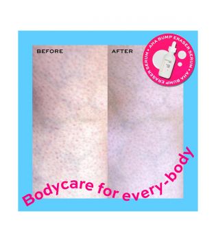 Revolution Skincare - *Body Skincare* - Soro Corporal AHA Bump Eraser