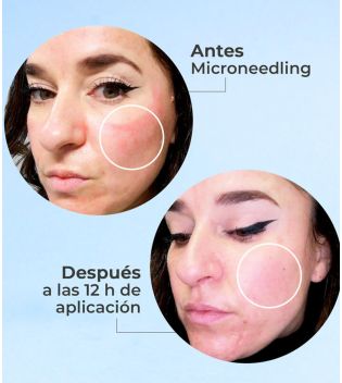 SEGLE - Sérum facial regenerador antienvelhecimento Skin Factor - Pele sensível
