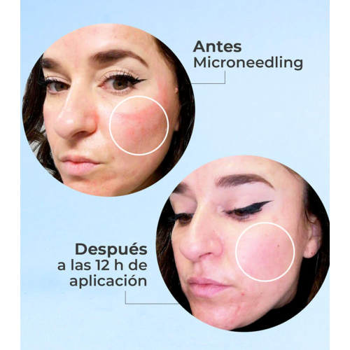 SEGLE - Sérum facial regenerador antienvelhecimento Skin Factor - Pele sensível