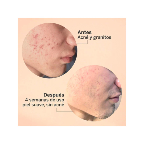 SEGLE - Soro facial esfoliante AHA/BHA