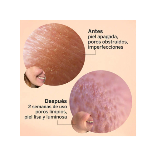 SEGLE - Glycolmix Soro Facial Esfoliante com Ácido Glicólico