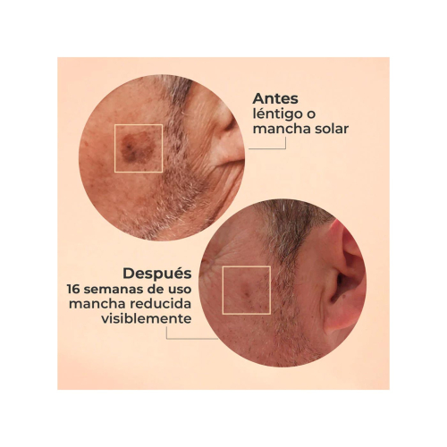 SEGLE - Glycolmix Soro Facial Esfoliante com Ácido Glicólico