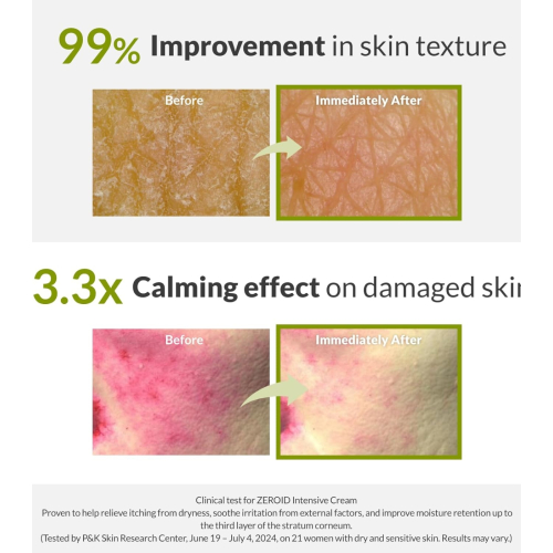 Zeroid - Creme intensivo reparador